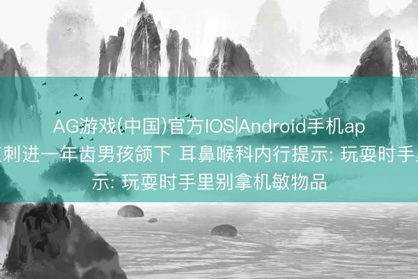 AG游戏(中国)官方IOS|Android手机app下载 铅笔径直刺进一年齿男孩颌下 耳鼻喉科内行提示: 玩耍时手里别拿机敏物品